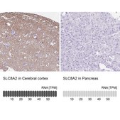 Anti-SLC8A2 antibody produced in rabbit Prestige Antibodies® Powered by Atlas Antibodies, affinity isolated antibody, buffered aqueous glycerol solution