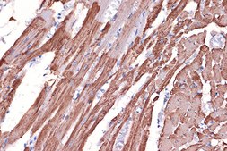 Anti-Tropomyosin 1 Antibody, clone 5Q2H6, Rabbit Monoclonal