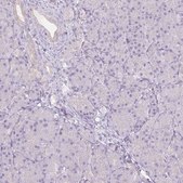 Anti-CTNNA3 antibody produced in rabbit Prestige Antibodies® Powered by Atlas Antibodies, affinity isolated antibody, buffered aqueous glycerol solution