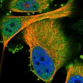 Anti-PRKCH antibody produced in rabbit Prestige Antibodies® Powered by Atlas Antibodies, affinity isolated antibody, buffered aqueous glycerol solution