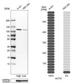 Anti-ACTN1 antibody produced in rabbit Prestige Antibodies® Powered by Atlas Antibodies, affinity isolated antibody, buffered aqueous glycerol solution