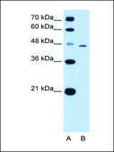 Anti-TAPBP antibody produced in rabbit affinity isolated antibody