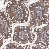 Anti-CHPF antibody produced in rabbit Prestige Antibodies® Powered by Atlas Antibodies, affinity isolated antibody, buffered aqueous glycerol solution