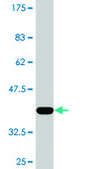 Monoclonal Anti-RAD23B, (C-terminal) antibody produced in mouse clone 3H7, purified immunoglobulin, buffered aqueous solution