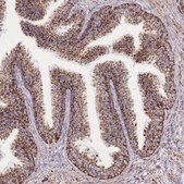 Anti-GSTM1 antibody produced in rabbit Prestige Antibodies® Powered by Atlas Antibodies, affinity isolated antibody, buffered aqueous glycerol solution