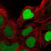 Anti-ZNF444 antibody produced in rabbit Prestige Antibodies® Powered by Atlas Antibodies, affinity isolated antibody