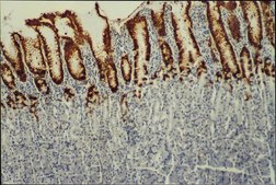 Anti-Mucin MUC5AC Antibody, clone CLH2 clone CLH2, Chemicon®, from mouse