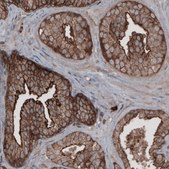 Monoclonal Anti-EZR antibody produced in mouse Prestige Antibodies® Powered by Atlas Antibodies, clone CL2360, purified immunoglobulin, buffered aqueous glycerol solution