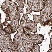 Anti-EPC2 antibody produced in rabbit Prestige Antibodies® Powered by Atlas Antibodies, affinity isolated antibody, buffered aqueous glycerol solution