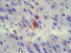 Anti-Substance P Receptor Antibody, pain serum, Chemicon®