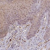 Anti-CNTRL antibody produced in rabbit Prestige Antibodies® Powered by Atlas Antibodies, affinity isolated antibody, buffered aqueous glycerol solution