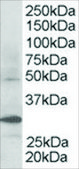 Anti-FBXW2 antibody produced in goat affinity isolated antibody, buffered aqueous solution