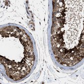 Anti-SRPK1 antibody produced in rabbit Prestige Antibodies® Powered by Atlas Antibodies, affinity isolated antibody, buffered aqueous glycerol solution