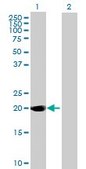 Anti-DUSP14 antibody produced in mouse purified immunoglobulin, buffered aqueous solution