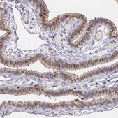 Anti-ATF3 antibody produced in rabbit Prestige Antibodies® Powered by Atlas Antibodies, affinity isolated antibody, buffered aqueous glycerol solution