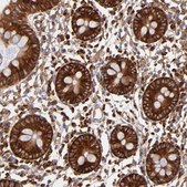Anti-FARSA antibody produced in rabbit Prestige Antibodies® Powered by Atlas Antibodies, affinity isolated antibody, buffered aqueous glycerol solution
