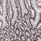 Anti-MRE11 antibody produced in rabbit Prestige Antibodies® Powered by Atlas Antibodies, affinity isolated antibody, buffered aqueous glycerol solution