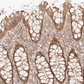 Anti-PPP1R3B antibody produced in rabbit Prestige Antibodies® Powered by Atlas Antibodies, affinity isolated antibody, buffered aqueous glycerol solution