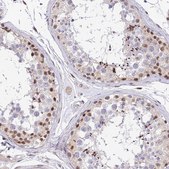 Anti-BCL9 antibody produced in rabbit Prestige Antibodies® Powered by Atlas Antibodies, affinity isolated antibody, buffered aqueous glycerol solution