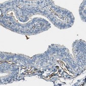 Anti-PLXDC1 antibody produced in rabbit Prestige Antibodies® Powered by Atlas Antibodies, affinity isolated antibody, buffered aqueous glycerol solution