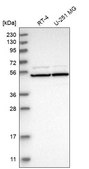 Anti-RAD23A antibody produced in rabbit Prestige Antibodies® Powered by Atlas Antibodies, affinity isolated antibody