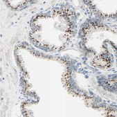 Anti-B4GALT1 antibody produced in rabbit Ab1, Prestige Antibodies® Powered by Atlas Antibodies, affinity isolated antibody, buffered aqueous glycerol solution