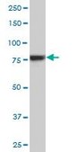 Monoclonal Anti-RPS6KA6 antibody produced in mouse clone 6F2, purified immunoglobulin, buffered aqueous solution