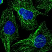 Anti-WBP1L antibody produced in rabbit Prestige Antibodies® Powered by Atlas Antibodies, affinity isolated antibody, buffered aqueous glycerol solution