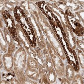 Anti-DHRS7 antibody produced in rabbit Prestige Antibodies® Powered by Atlas Antibodies, affinity isolated antibody, buffered aqueous glycerol solution