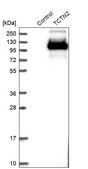 Anti-TCTN2 antibody produced in rabbit Prestige Antibodies® Powered by Atlas Antibodies, affinity isolated antibody, buffered aqueous glycerol solution