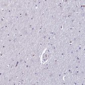 Anti-MFSD2B antibody produced in rabbit Prestige Antibodies® Powered by Atlas Antibodies, affinity isolated antibody, buffered aqueous glycerol solution