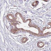 Anti-SNX1 antibody produced in rabbit Prestige Antibodies® Powered by Atlas Antibodies, affinity isolated antibody, buffered aqueous glycerol solution