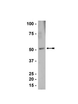 Anti-SKAP-55 Antibody Upstate&#174;, from rabbit