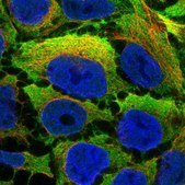 Anti-CNN2 antibody produced in rabbit Prestige Antibodies® Powered by Atlas Antibodies, affinity isolated antibody, buffered aqueous glycerol solution