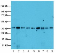 Anti-PP1β Antibody Upstate®, from rabbit