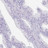 Anti-CSRP3 antibody produced in rabbit Prestige Antibodies® Powered by Atlas Antibodies, affinity isolated antibody, buffered aqueous glycerol solution
