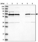 Anti-FAM160B2 antibody produced in rabbit Prestige Antibodies® Powered by Atlas Antibodies, affinity isolated antibody, buffered aqueous glycerol solution