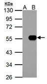 Anti-IP6K1 antibody produced in rabbit