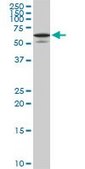 Monoclonal Anti-STXBP1 antibody produced in mouse clone 6D1, purified immunoglobulin, buffered aqueous solution
