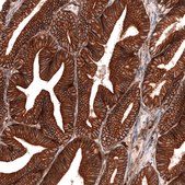 Monoclonal Anti-Igfbp2 Antibody Produced In Mouse Prestige Antibodies® Powered by Atlas Antibodies, clone CL13563, affinity isolated antibody, buffered aqueous glycerol solution