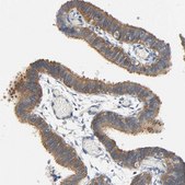 Anti-ARPC1A antibody produced in rabbit Prestige Antibodies® Powered by Atlas Antibodies, affinity isolated antibody, buffered aqueous glycerol solution