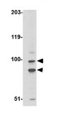 Anti-SATB1 Antibody from rabbit, purified by affinity chromatography