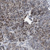 Anti-CCM2 antibody produced in rabbit Prestige Antibodies® Powered by Atlas Antibodies, affinity isolated antibody, buffered aqueous glycerol solution, Ab1