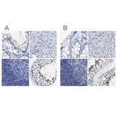Anti-HOOK1 antibody produced in rabbit Prestige Antibodies® Powered by Atlas Antibodies, affinity isolated antibody, buffered aqueous glycerol solution, Ab1