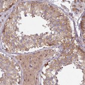 Anti-STAM antibody produced in rabbit Prestige Antibodies® Powered by Atlas Antibodies, affinity isolated antibody, buffered aqueous glycerol solution
