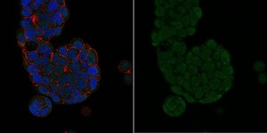 Anti-MGMT Antibody, clone MT 3.1, Alexa Fluor™ 488 Conjugate clone MT3.1, from mouse, ALEXA FLUOR™ 488