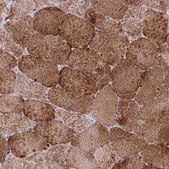Anti-CHCHD3 antibody produced in rabbit Prestige Antibodies® Powered by Atlas Antibodies, affinity isolated antibody, buffered aqueous glycerol solution