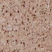 Monoclonal Anti-SORT1 antibody produced in mouse Prestige Antibodies® Powered by Atlas Antibodies, clone CL6528, purified immunoglobulin, buffered aqueous glycerol solution