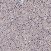 Anti-ARNT antibody produced in rabbit Prestige Antibodies® Powered by Atlas Antibodies, affinity isolated antibody, buffered aqueous glycerol solution