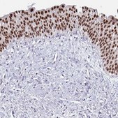 Anti-FOXA1 antibody produced in rabbit Prestige Antibodies® Powered by Atlas Antibodies, affinity isolated antibody, buffered aqueous glycerol solution
